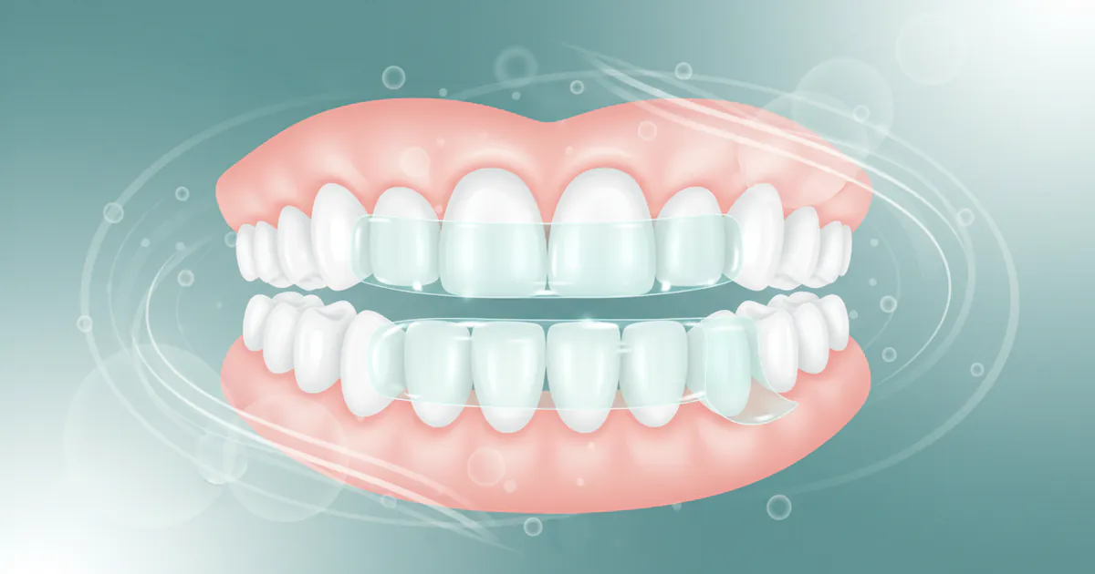 Best Teeth Whitening Strips: Complete Guide