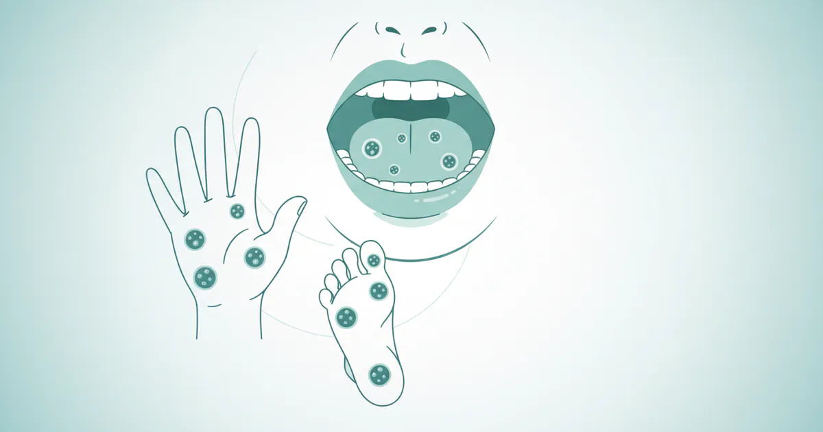 Can Adults Get Hand Foot and Mouth