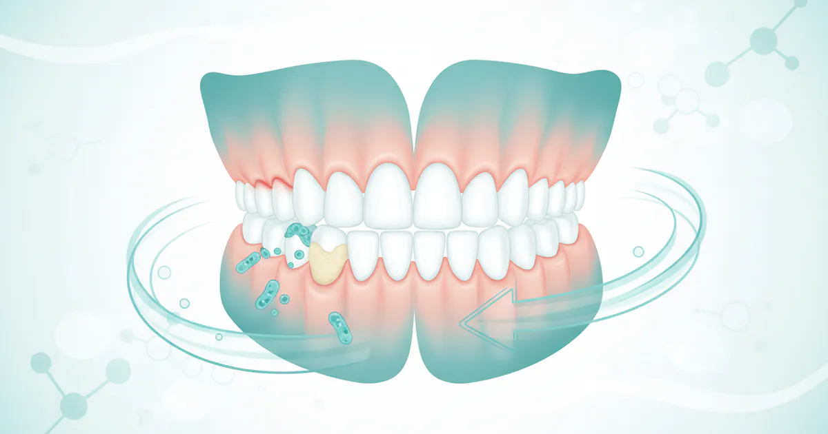 Can You Get Rid of Gingivitis