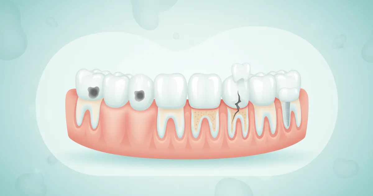 Complete Guide to Dental Conditions & Diseases: Everything You Need to Know