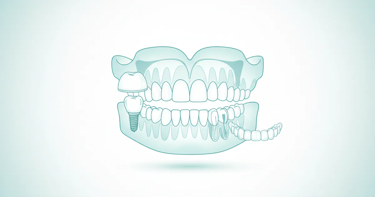 Complete Guide to Restorative Dentistry: Everything You Need to Know