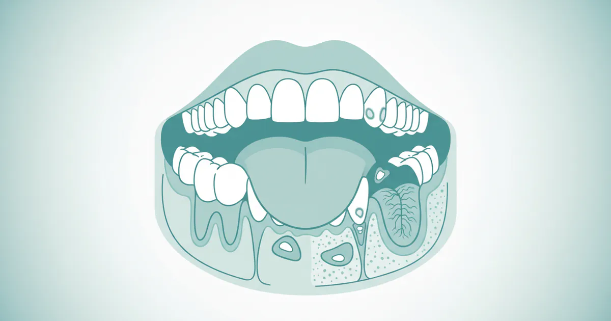 Complete Guide to Soft Tissue & Oral Conditions: Everything You Need to Know