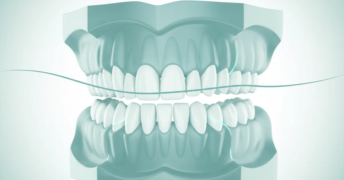 Crooked Teeth: Complete Guide