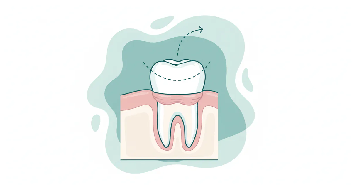 Crown Lengthening: Complete Guide