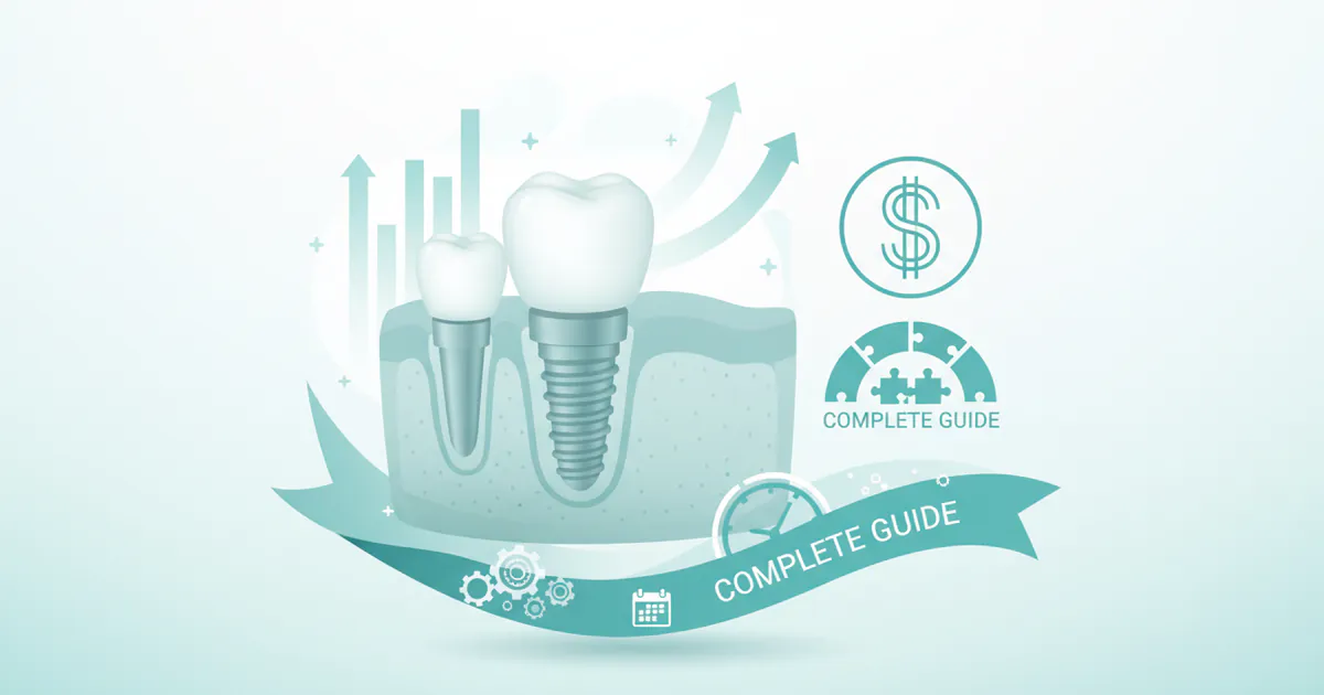 Average Cost of Tooth Implant: Complete Price Guide 2026