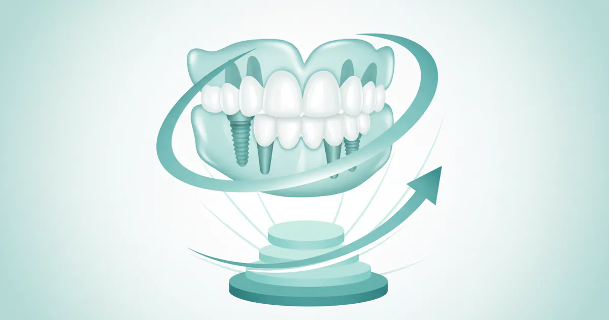 Cost of Implant Dentures: Complete Price Guide 2026