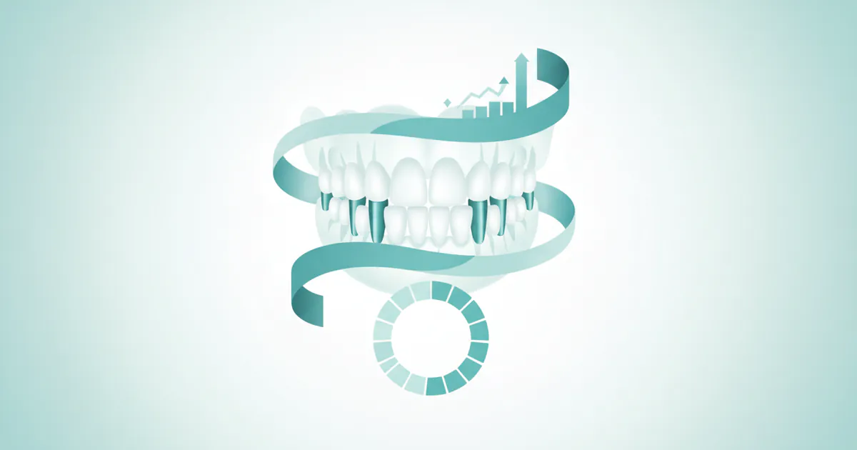 Cost of Teeth Implants: Complete Price Guide 2026