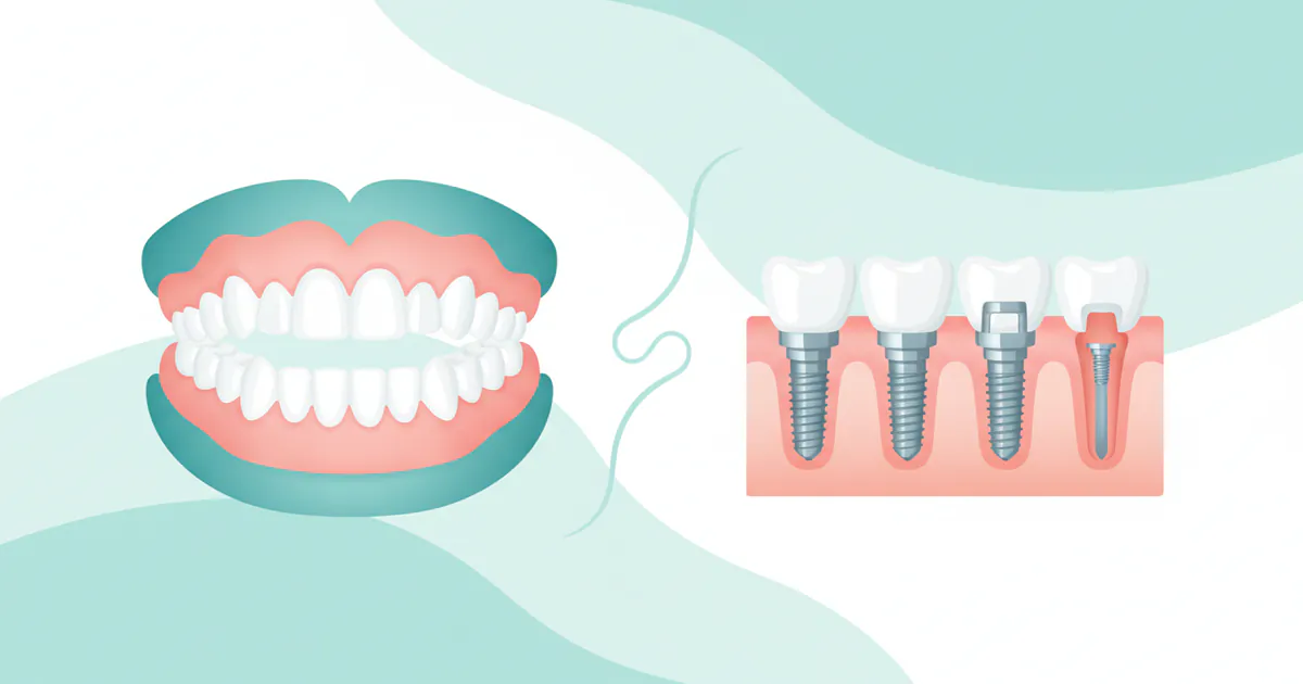 Dentures Versus Implants: Complete Guide