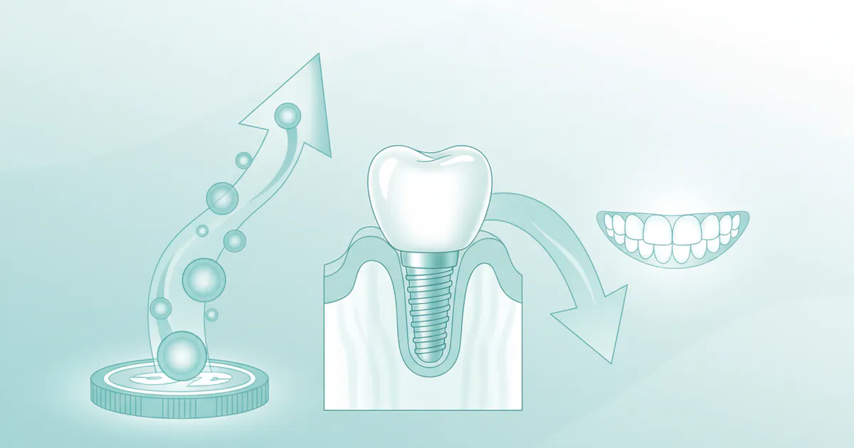 How Much Does an Implant Tooth Cost