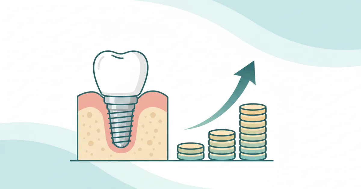 How Much for Tooth Implant