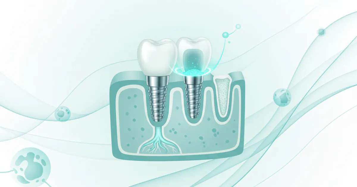 Innovative Implant and Oral Surgery: Complete Guide