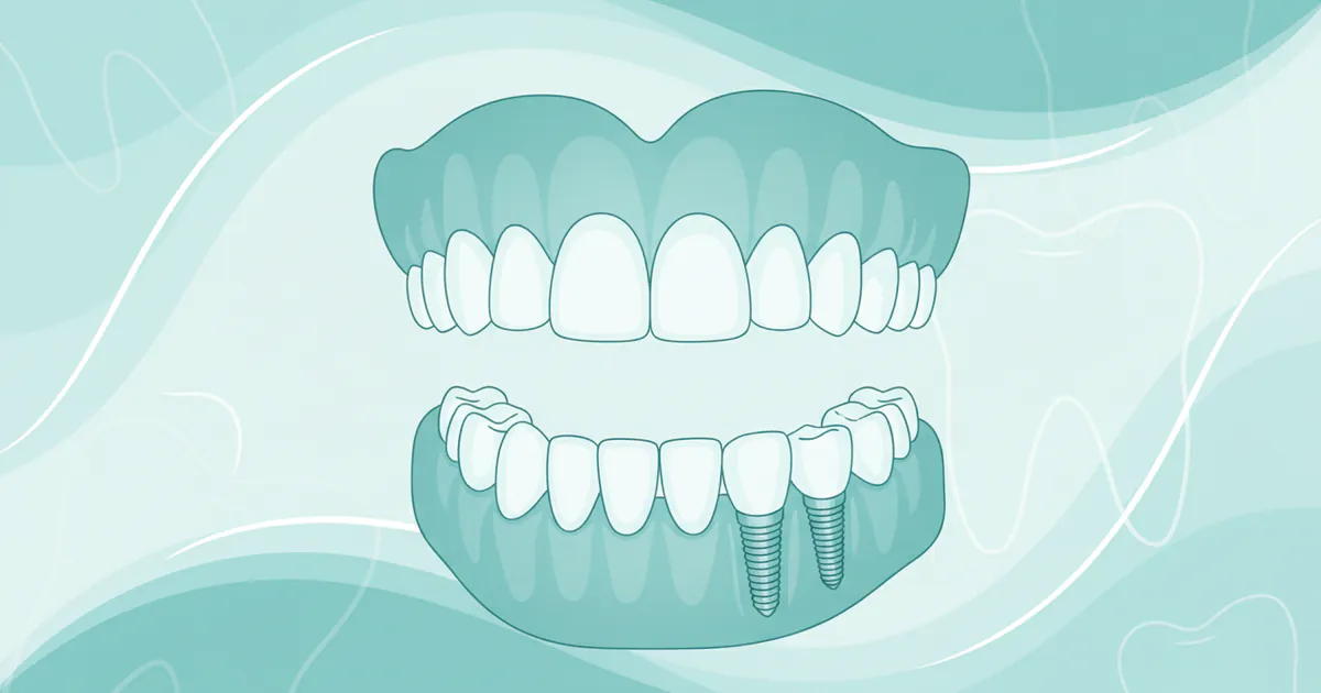 Memphis Dentures and Implants: Complete Guide