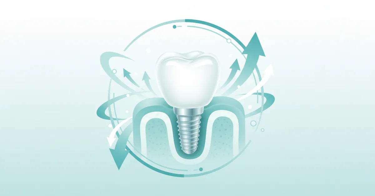 One Tooth Implant Cost: Complete Price Guide 2026