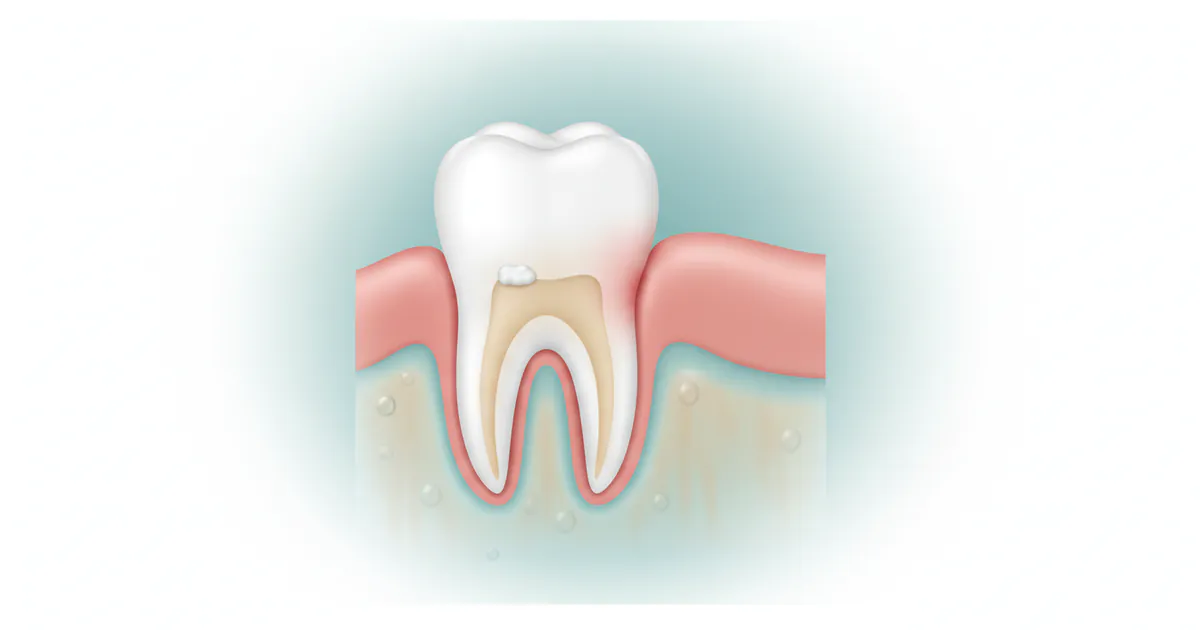 Early Stage Gum Disease Pictures: Complete Guide