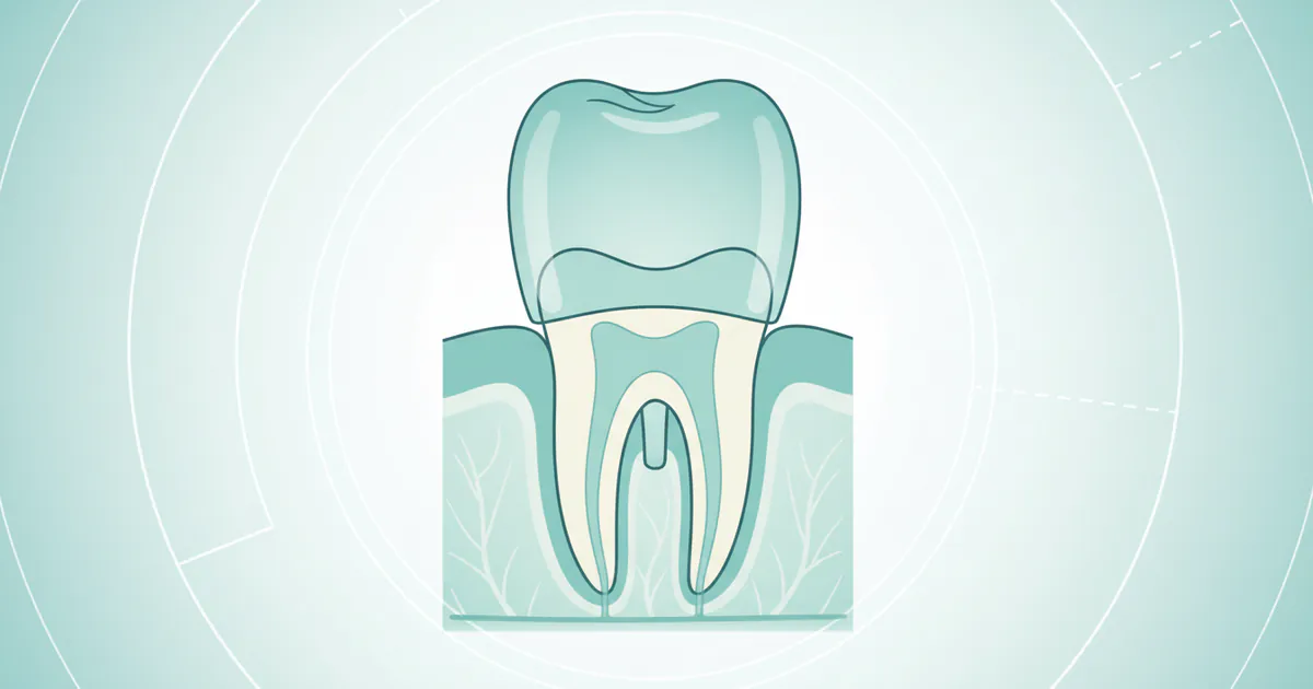 Front Tooth Crown: Complete Guide