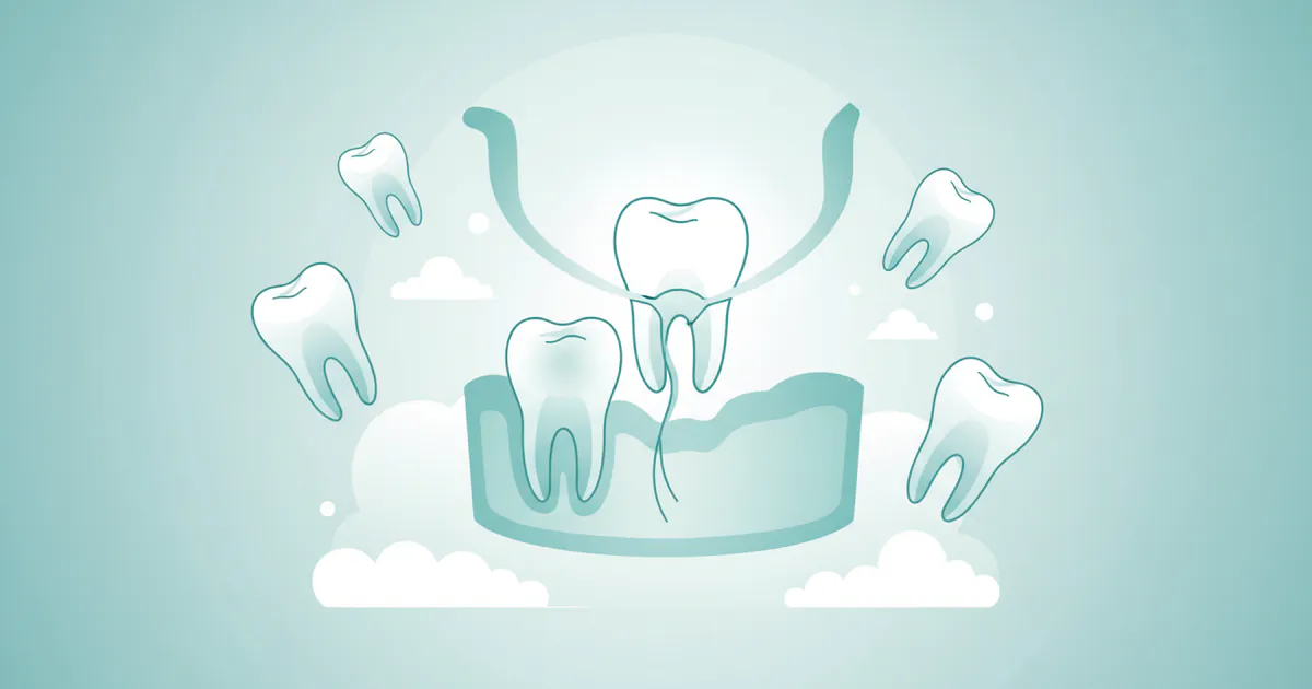 Extraction: Complete Dental Guide