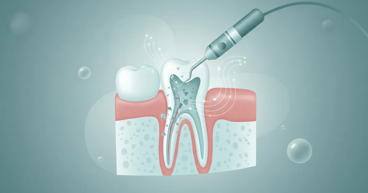 Gum Disease Medical Procedure: Complete Guide