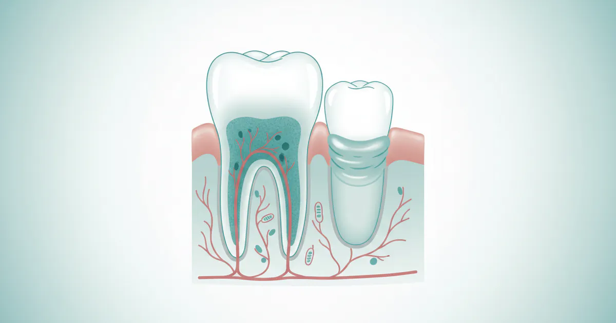 Gum Infection: Complete Guide