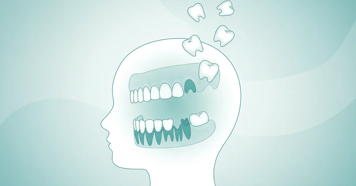 How Many Baby Teeth Do You Lose