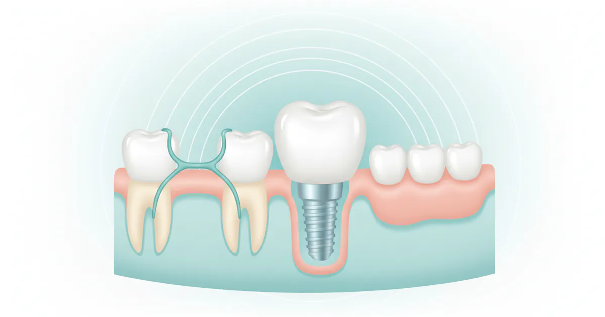 How Much Does a Fake Tooth Cost