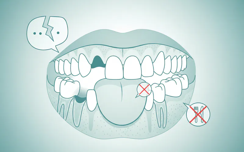 Illustration related to 5 Tooth Bridge: Complete Guide