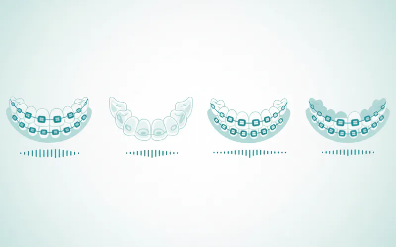 Illustration related to Average US Cost Ranges by Type