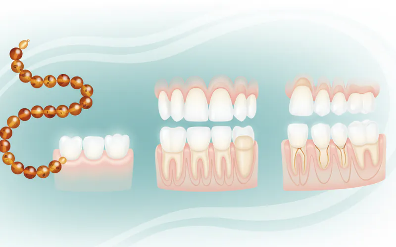 Illustration related to Children / Pediatric Considerations: Understanding Tooth Development