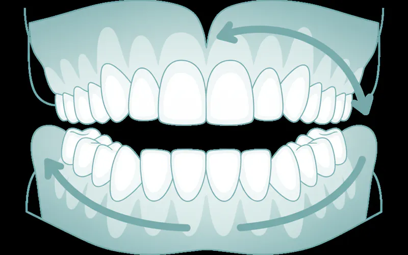 Illustration related to The Universal Numbering System (UNS)