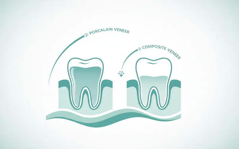 Illustration related to Frequently Asked Questions