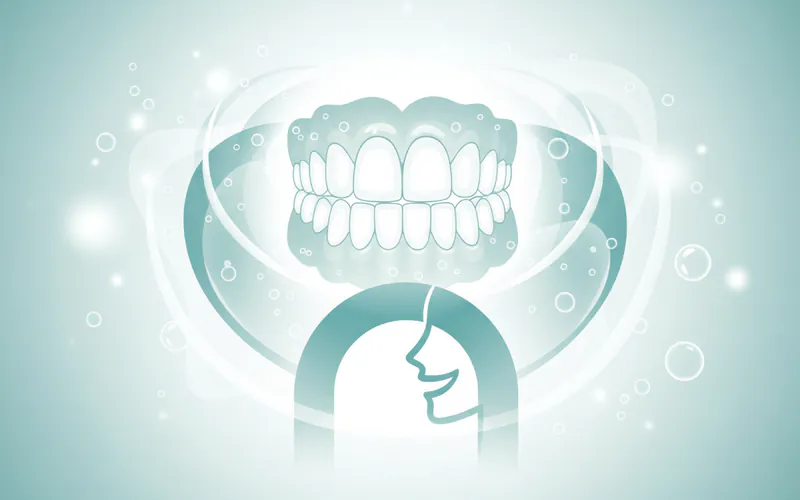 Illustration related to Denture Cleaner: Complete Guide