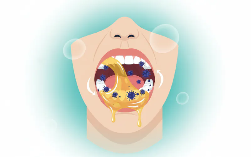 A diagram illustrating the oil pulling process, showing a person swishing oil in their mouth, with bacteria and toxins being "pulled" into the oil from the teeth and gums.