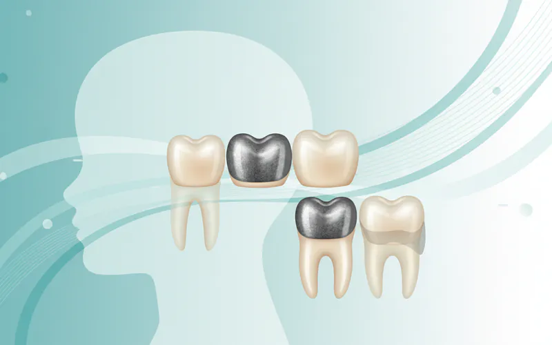 Illustration related to For Parents / Pediatric Considerations