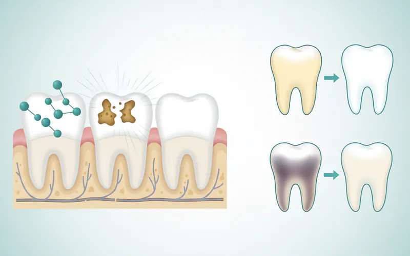 Illustration related to Key Takeaways: