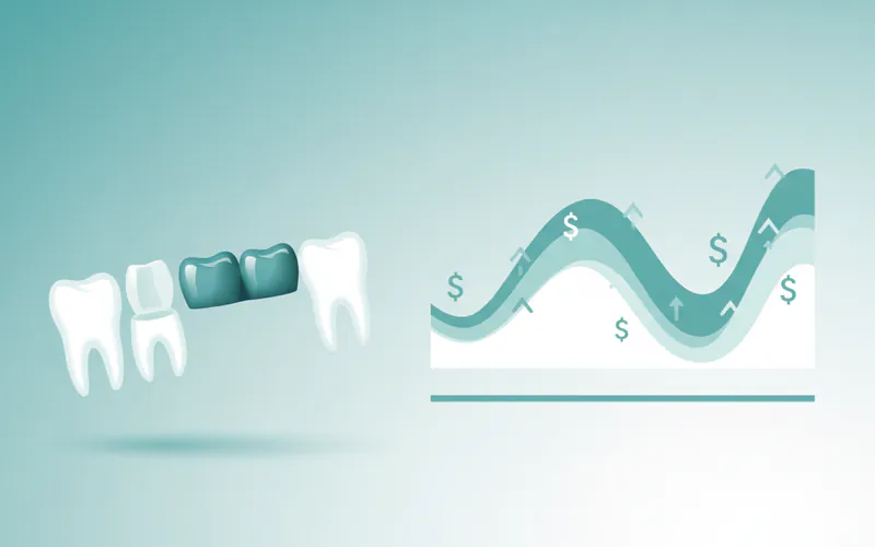 Illustration related to How much does a dental bridge cost?