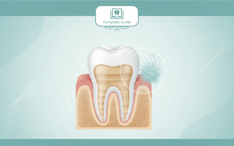 Illustration related to Composite