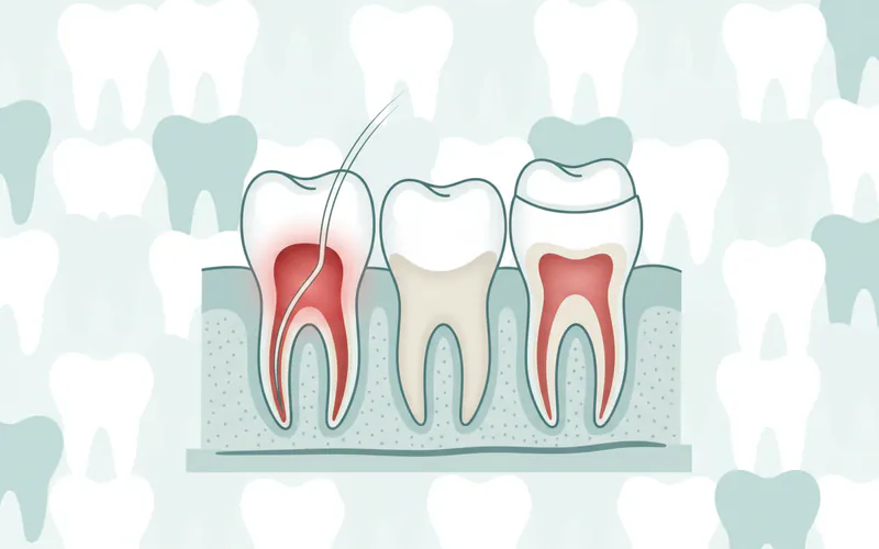 Illustration related to For Parents / Pediatric Considerations