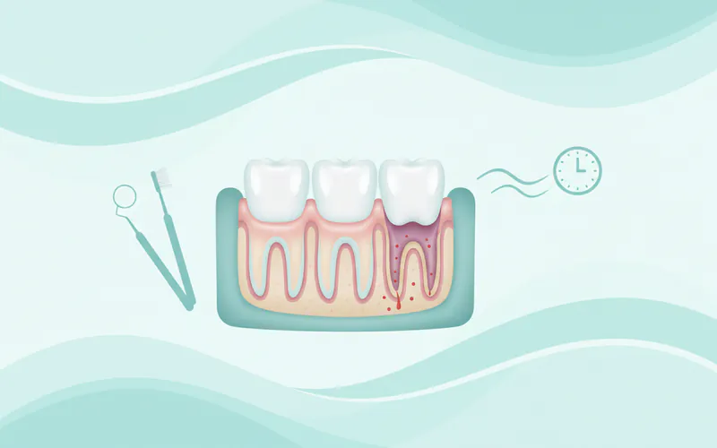 Illustration related to When to See a Dentist