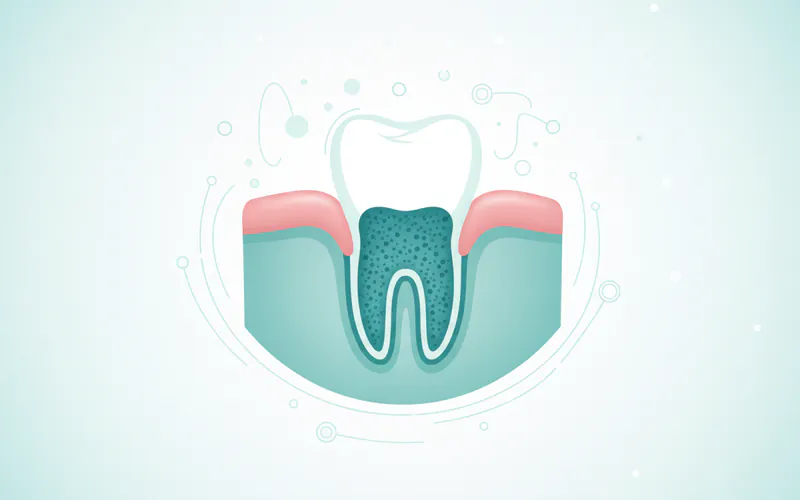 Illustration related to Graft: Rebuilding the Foundations of a Healthy Smile