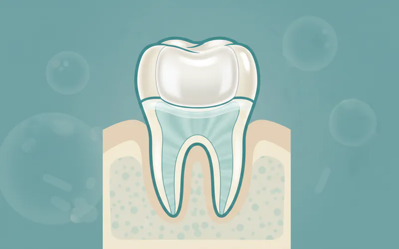 Illustration related to Laminate: Your Comprehensive Guide to Dental Veneers and Smile Enhancement