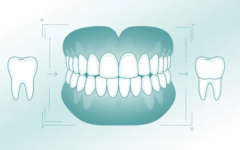 Illustration related to Detailed Explanation