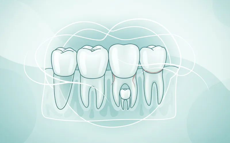 Illustration related to For Parents / Pediatric Considerations