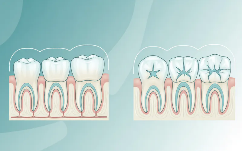 Illustration related to Detailed Explanation