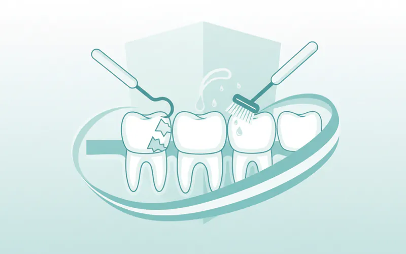 Illustration related to Prophylaxis: Your Definitive Guide to Professional Dental Cleanings