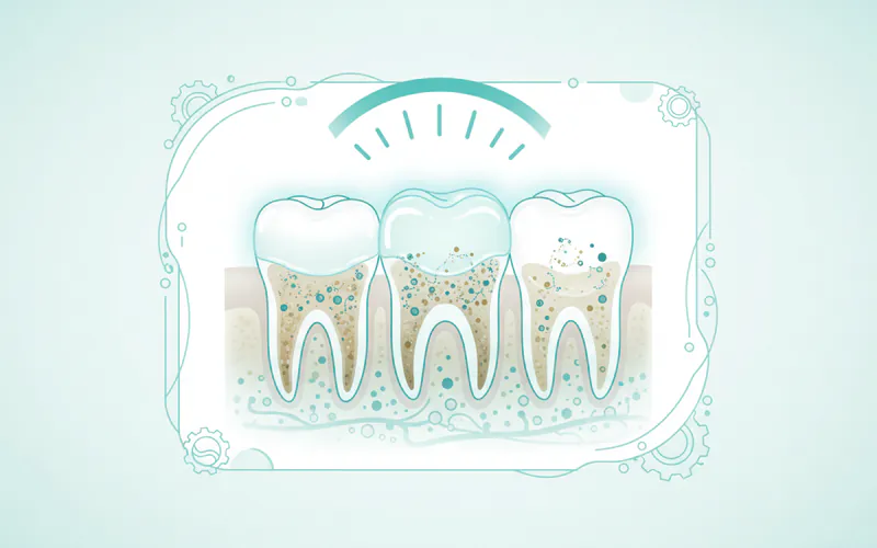 Illustration related to Tooth Whitening