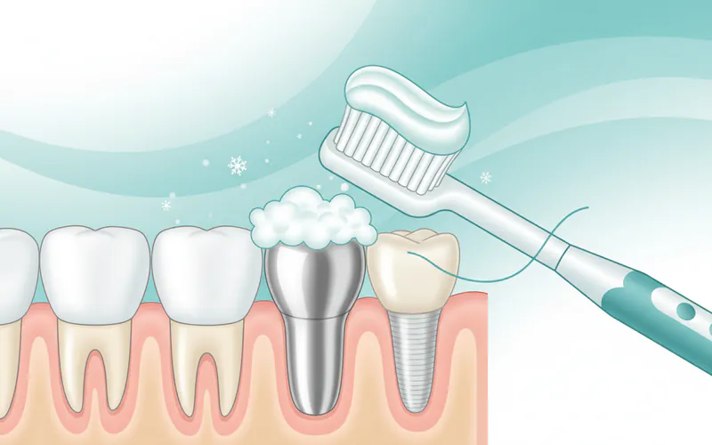 Illustration related to Oral Hygiene Practices