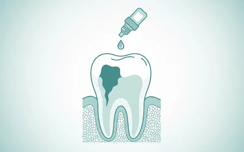 Illustration related to 4. Tooth Preparation