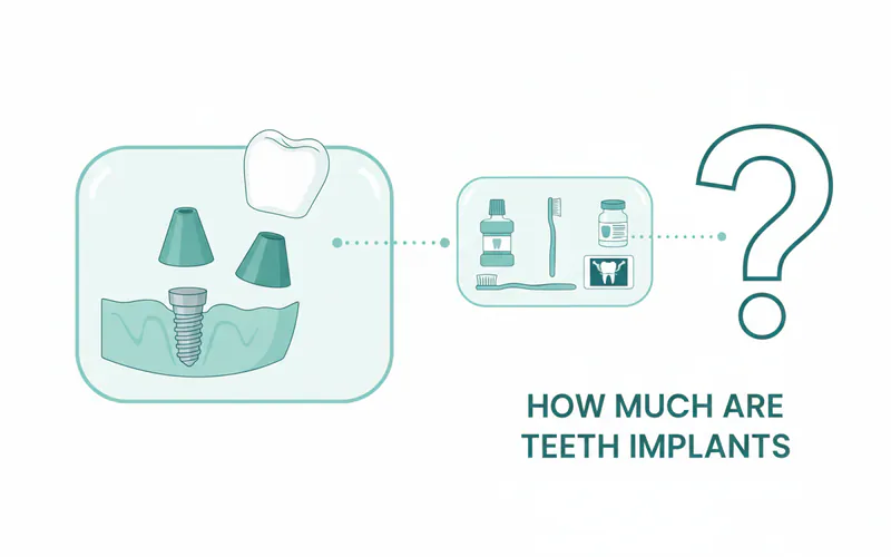 Illustration related to Deconstructing the "How Much Are Teeth Implants" Question