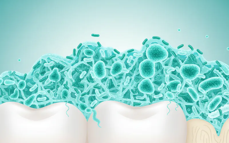 Microscopic view of oral bacteria forming biofilm on a tooth surface