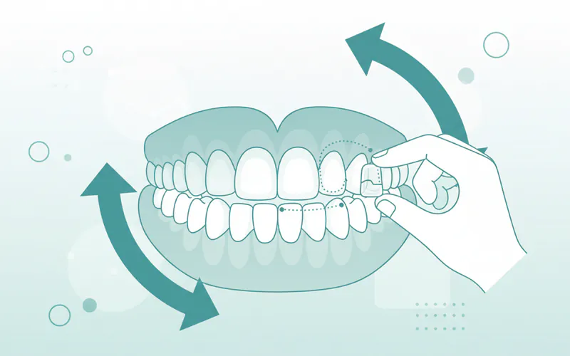 Illustration related to Step 5: Refinements and Completion