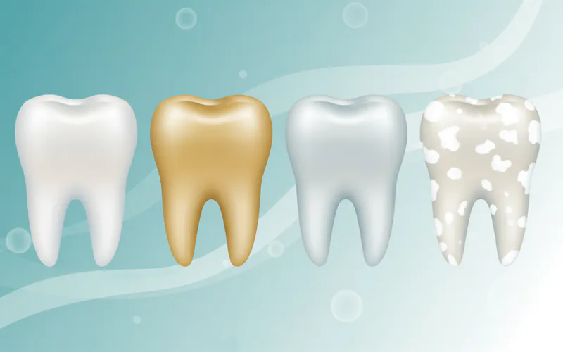 illustration showing different types of tooth discoloration, e.g., yellowing from coffee, graying from medication, white spots from fluorosis